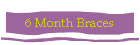 6 Month Braces