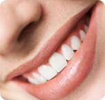 Dr Ghassan Dental Clinc | Qatar | Dental Braces